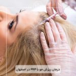 درمان-ریزش-مو-با-PRP-در-اصفهان