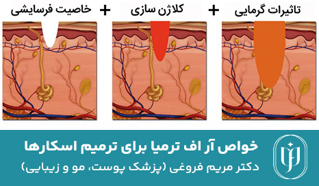 خواص-آر-اف-ترمیا-برای-ترمیم-اسکارها